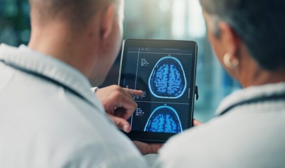 Studio sulla fibrillazione atriale e declino cognitivo